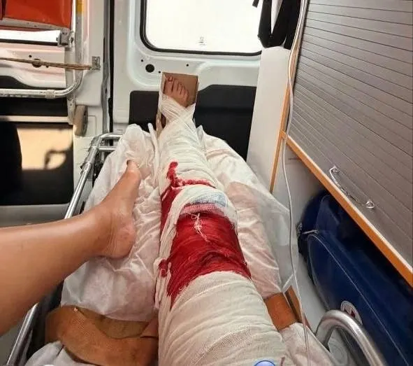Певица получила травму дома 12 июня и была доставлена в больницу. Перелома, по данным источников, нет; концерт 13 июня пока сохраняется, окончательное решение объявят позже.