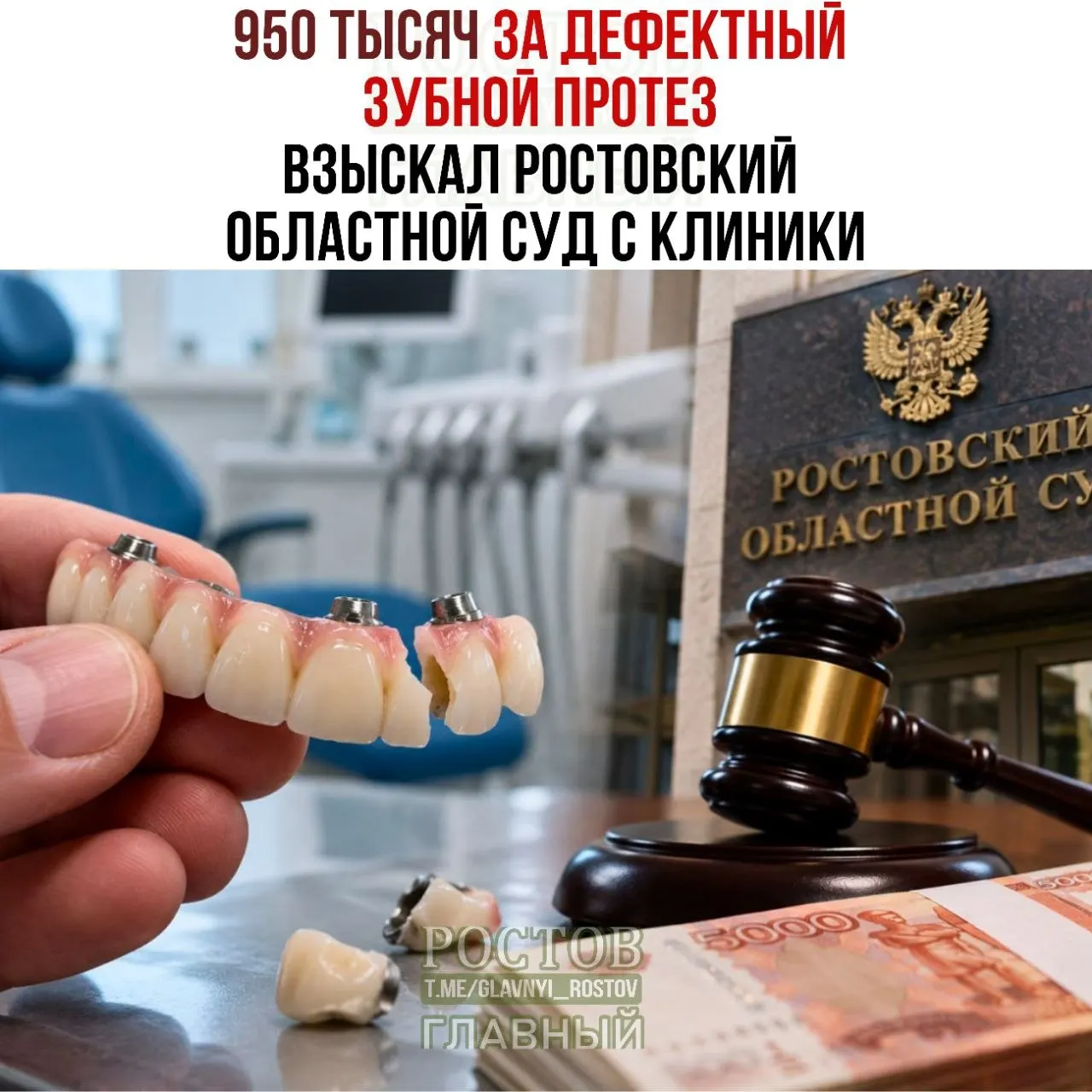 После установки четырех имплантов пациенту стало трудно жевать; суд обязал клинику выплатить стоимость услуг, моральный вред и штраф.